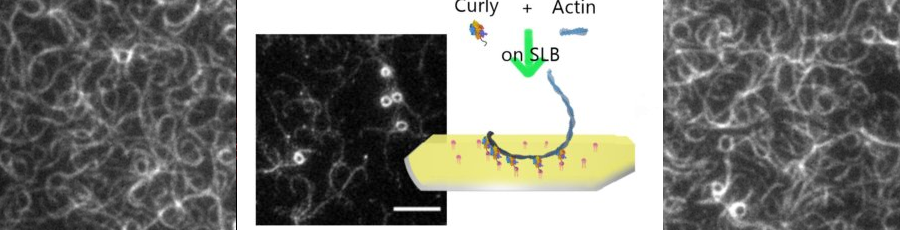 TIRF image of actin bound in rings by curly tethered to a supported lipid bilayer