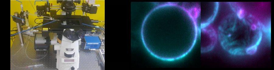 Our micropipette aspiration setup and lattice light sheet images of actin covered giant lipid vesicles