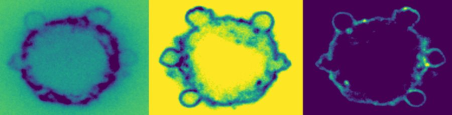 Confocal images of a blebbing cell